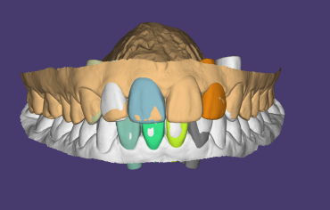 Odontologia digital y tecnología de vanguardia