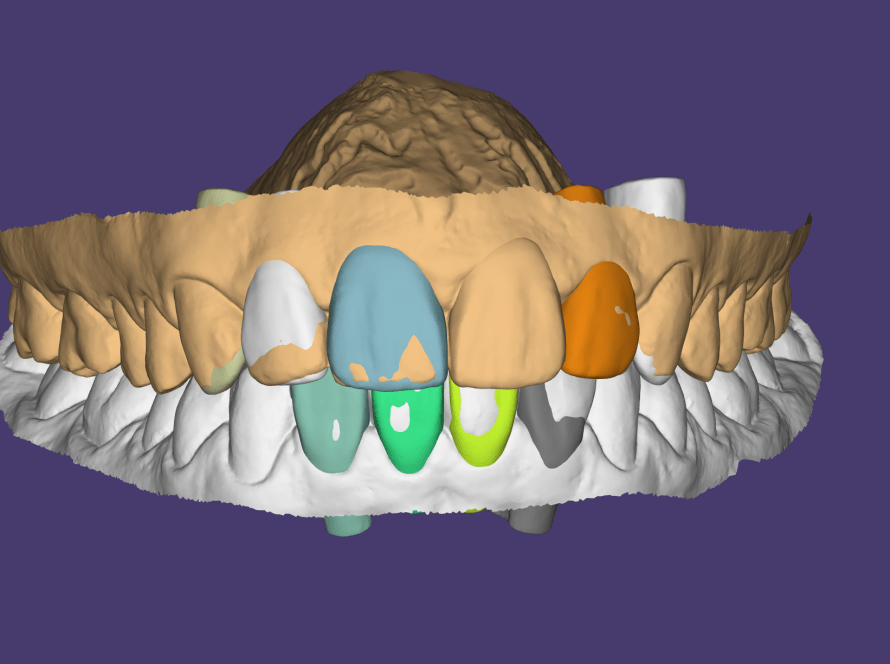 Odontologia digital y tecnología de vanguardia