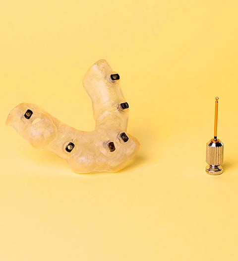 Implantología en Pamplona